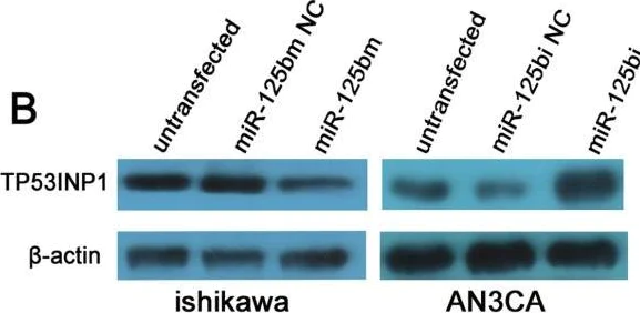 Western blot - Anti-TP53INP1 antibody (AB9775)
