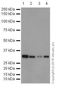 Western blot - Anti-TP53INP1 antibody [EPR17974] (AB202026)