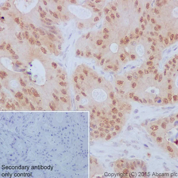 Immunohistochemistry (Formalin/PFA-fixed paraffin-embedded sections) - Anti-TP53INP1 antibody [EPR17974] - BSA and Azide free (AB240362)