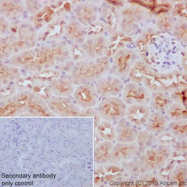 Immunohistochemistry (Formalin/PFA-fixed paraffin-embedded sections) - Anti-TP53INP1 antibody [EPR17974] - BSA and Azide free (AB240362)