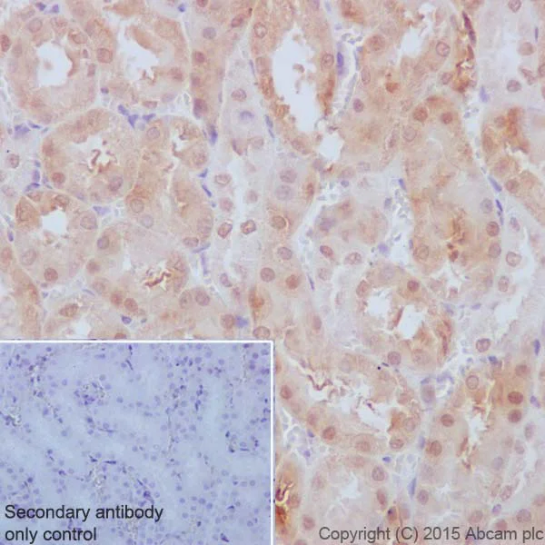Immunohistochemistry (Formalin/PFA-fixed paraffin-embedded sections) - Anti-TP53INP1 antibody [EPR17974] - BSA and Azide free (AB240362)