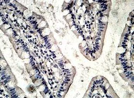 Immunohistochemistry (Formalin/PFA-fixed paraffin-embedded sections) - Anti-TPC2 antibody (AB119915)