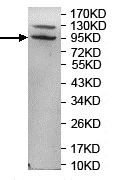Western blot - Anti-TPC2 antibody (AB119915)