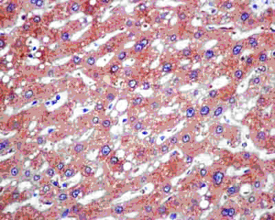 Immunohistochemistry (Formalin/PFA-fixed paraffin-embedded sections) - Anti-TPD52 antibody [EPR14219] (AB181260), expandable thumbnail