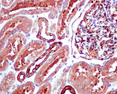 Immunohistochemistry (Formalin/PFA-fixed paraffin-embedded sections) - Anti-TPD52 antibody [EPR14219] (AB181260), expandable thumbnail