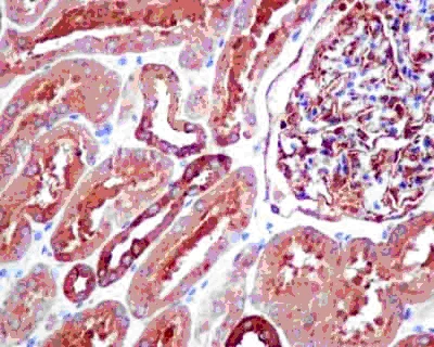 Immunohistochemistry (Formalin/PFA-fixed paraffin-embedded sections) - Anti-TPD52 antibody [EPR14219] (AB181260)
