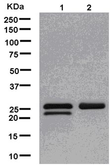 Western blot - Anti-TPD52 antibody [EPR14219] (AB181260), expandable thumbnail