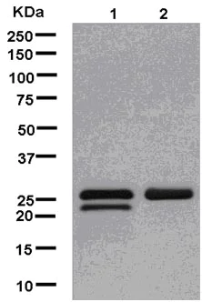 Western blot - Anti-TPD52 antibody [EPR14219] (AB181260)