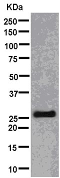 Western blot - Anti-TPD52 antibody [EPR14219] (AB181260), expandable thumbnail