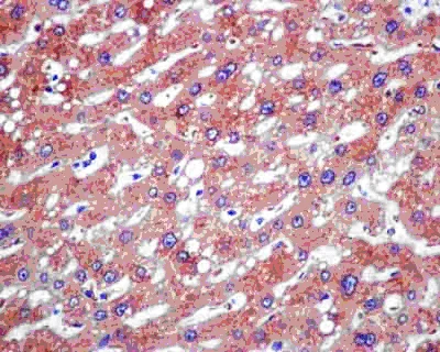 Immunohistochemistry (Formalin/PFA-fixed paraffin-embedded sections) - Anti-TPD52 antibody [EPR14219] - BSA and Azide free (AB250473)