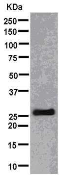 Western blot - Anti-TPD52 antibody [EPR14219] - BSA and Azide free (AB250473)