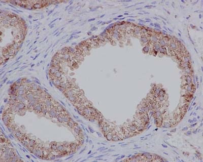 Immunohistochemistry (Formalin/PFA-fixed paraffin-embedded sections) - Anti-TPD52 antibody [EPR14220] - BSA and Azide free (ab250629), expandable thumbnail