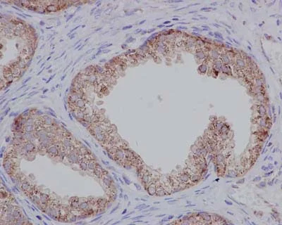 Immunohistochemistry (Formalin/PFA-fixed paraffin-embedded sections) - Anti-TPD52 antibody [EPR14220] - BSA and Azide free (AB250629)