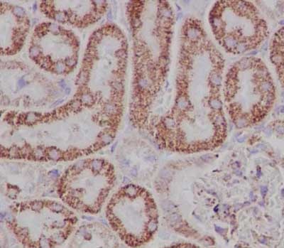 Immunohistochemistry (Formalin/PFA-fixed paraffin-embedded sections) - Anti-TPD52 antibody [EPR14220] - BSA and Azide free (AB250629), expandable thumbnail