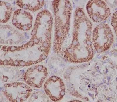 Immunohistochemistry (Formalin/PFA-fixed paraffin-embedded sections) - Anti-TPD52 antibody [EPR14220] - BSA and Azide free (AB250629)