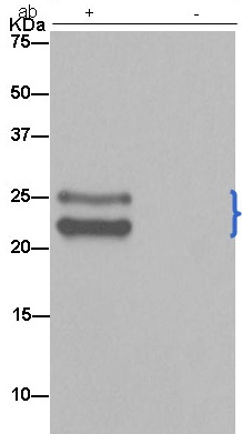 Immunoprecipitation - Anti-TPD52 antibody [EPR14220] - BSA and Azide free (AB250629), expandable thumbnail