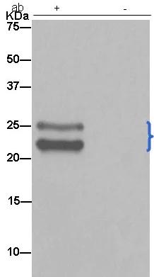 Immunoprecipitation - Anti-TPD52 antibody [EPR14220] - BSA and Azide free (AB250629)