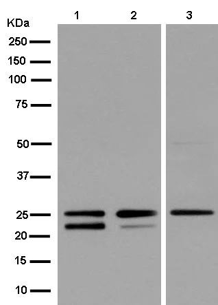 Western blot - Anti-TPD52 antibody [EPR14220] - BSA and Azide free (AB250629)