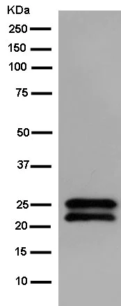 Western blot - Anti-TPD52 antibody [EPR14220] - BSA and Azide free (AB250629)