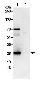 Immunoprecipitation - Anti-TPD52L2 antibody (AB194938)