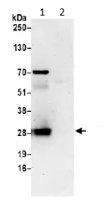 Immunoprecipitation - Anti-TPD52L2 antibody (AB194938)
