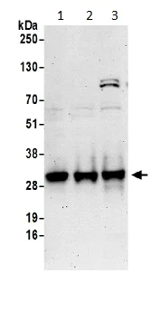 Western blot - Anti-TPD52L2 antibody (AB194938)
