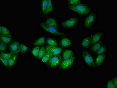 Immunocytochemistry/ Immunofluorescence - Anti-TPD52L2 antibody (AB234819), expandable thumbnail