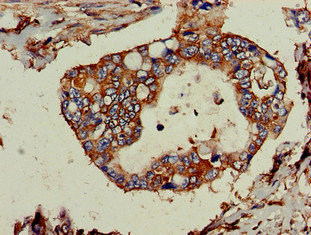 Immunohistochemistry (Formalin/PFA-fixed paraffin-embedded sections) - Anti-TPD52L2 antibody (AB234819), expandable thumbnail