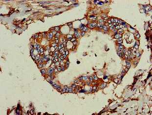 Immunohistochemistry (Formalin/PFA-fixed paraffin-embedded sections) - Anti-TPD52L2 antibody (AB234819)