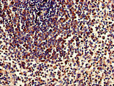 Immunohistochemistry (Formalin/PFA-fixed paraffin-embedded sections) - Anti-TPD52L2 antibody (AB234819), expandable thumbnail