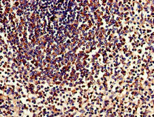 Immunohistochemistry (Formalin/PFA-fixed paraffin-embedded sections) - Anti-TPD52L2 antibody (AB234819)