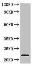 Western blot - Anti-TPD52L2 antibody (AB234819)