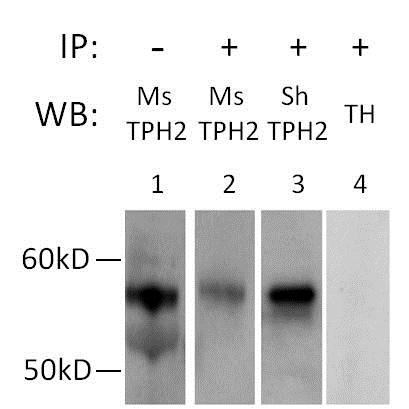 Immunoprecipitation - Anti-TPH2 antibody (AB111828)