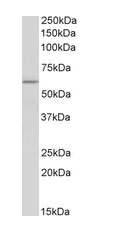 Western blot - Anti-TPH2 antibody (AB121013)