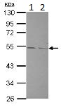 Western blot - Anti-TPH2 antibody (AB125877), expandable thumbnail