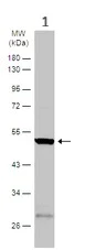 Western blot - Anti-TPH2 antibody (AB125877)