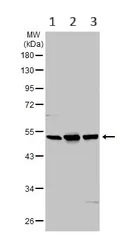 Western blot - Anti-TPH2 antibody (AB125877)
