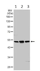 Western blot - Anti-TPH2 antibody (AB125877)