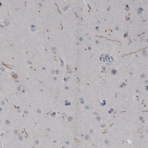 Immunohistochemistry (Formalin/PFA-fixed paraffin-embedded sections) - Anti-TPH2 antibody [CL2990] - C-terminal (AB211528)