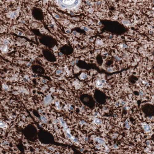 Immunohistochemistry (Formalin/PFA-fixed paraffin-embedded sections) - Anti-TPH2 antibody [CL2990] - C-terminal (AB211528)
