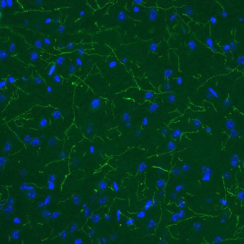 Immunohistochemistry (Formalin/PFA-fixed paraffin-embedded sections) - Anti-TPH2 antibody [CL2990] - C-terminal (AB211528)