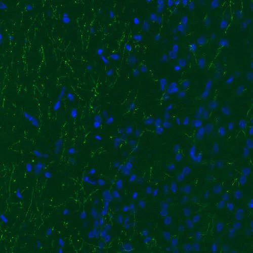 Immunohistochemistry (Formalin/PFA-fixed paraffin-embedded sections) - Anti-TPH2 antibody [CL2990] - C-terminal (AB211528)