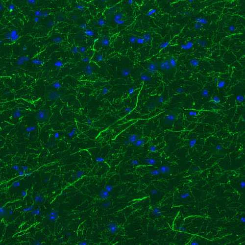 Immunohistochemistry (Formalin/PFA-fixed paraffin-embedded sections) - Anti-TPH2 antibody [CL2990] - C-terminal (AB211528)