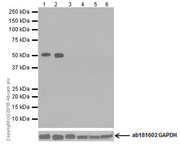 Western blot - Anti-TPH2 antibody [EPR19191] (AB184505)