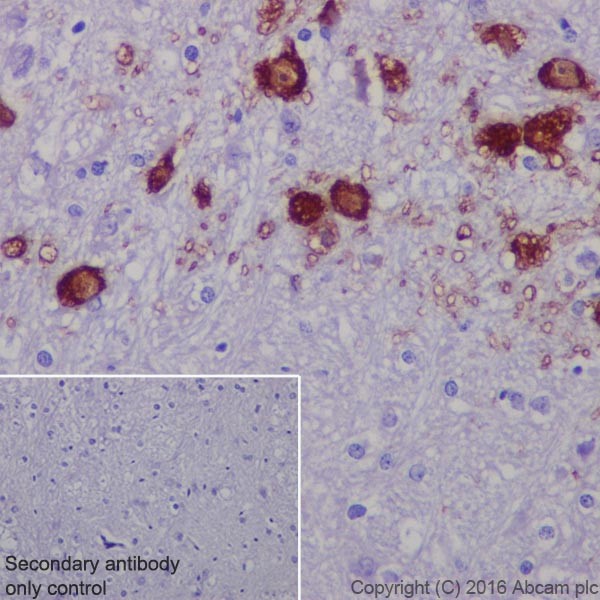 Immunohistochemistry (Formalin/PFA-fixed paraffin-embedded sections) - Anti-TPH2 antibody [EPR19191] - BSA and Azide free (AB240286), expandable thumbnail