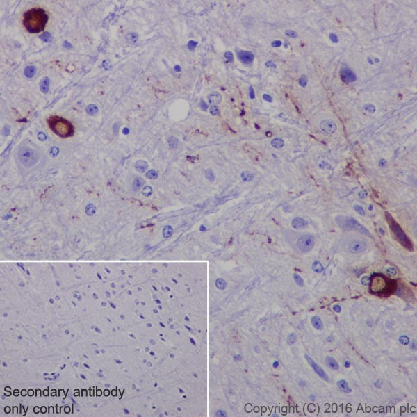 Immunohistochemistry (Formalin/PFA-fixed paraffin-embedded sections) - Anti-TPH2 antibody [EPR19191] - BSA and Azide free (AB240286), expandable thumbnail