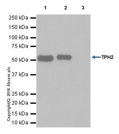 Immunoprecipitation - Anti-TPH2 antibody [EPR19191] - BSA and Azide free (AB240286), expandable thumbnail