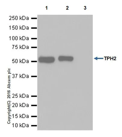 Immunoprecipitation - Anti-TPH2 antibody [EPR19191] - BSA and Azide free (AB240286)