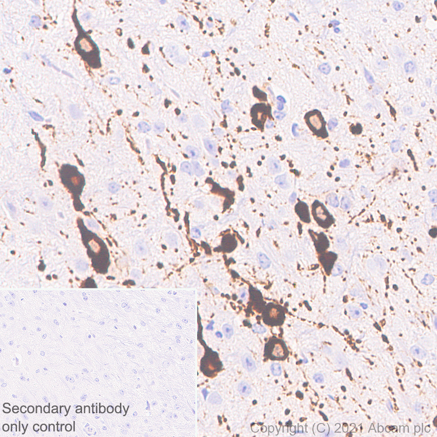 Immunohistochemistry (Formalin/PFA-fixed paraffin-embedded sections) - Anti-TPH2 antibody [EPR25100-29] (ab288067), expandable thumbnail