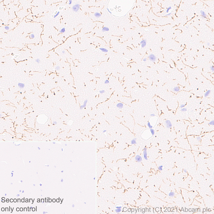 Immunohistochemistry (Formalin/PFA-fixed paraffin-embedded sections) - Anti-TPH2 antibody [EPR25100-29] (ab288067), expandable thumbnail